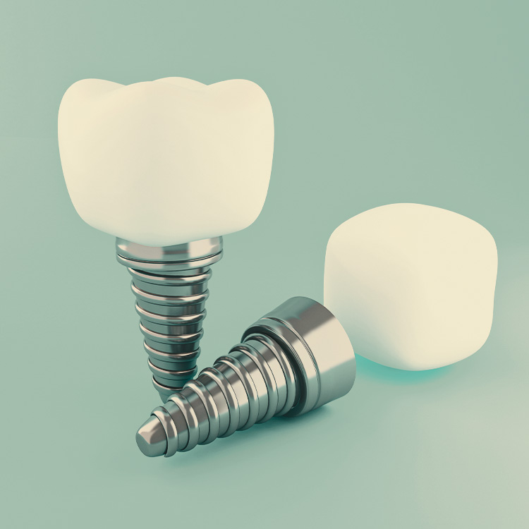 implantes-dentales-1