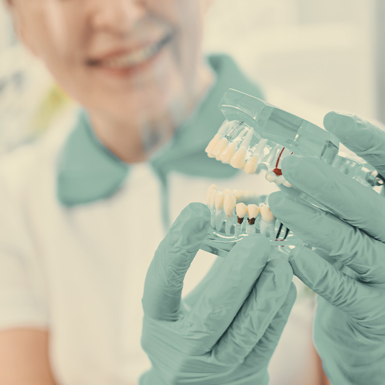 implantes-dentales-3