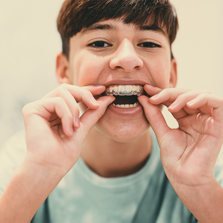 invisible-ortodoncia